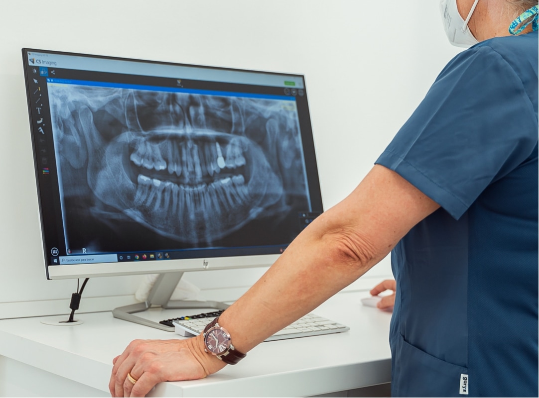 Inés Robles revisando una radiografía